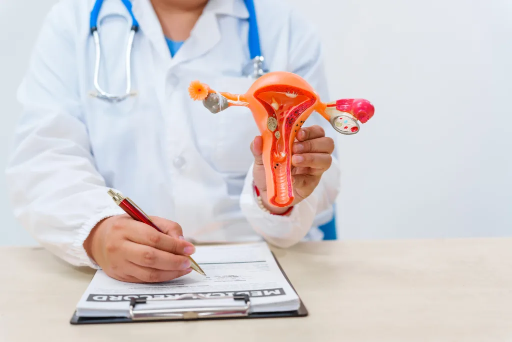 Médecin tenant une maquette anatomique de l'utérus et des ovaires tout en remplissant un dossier médical